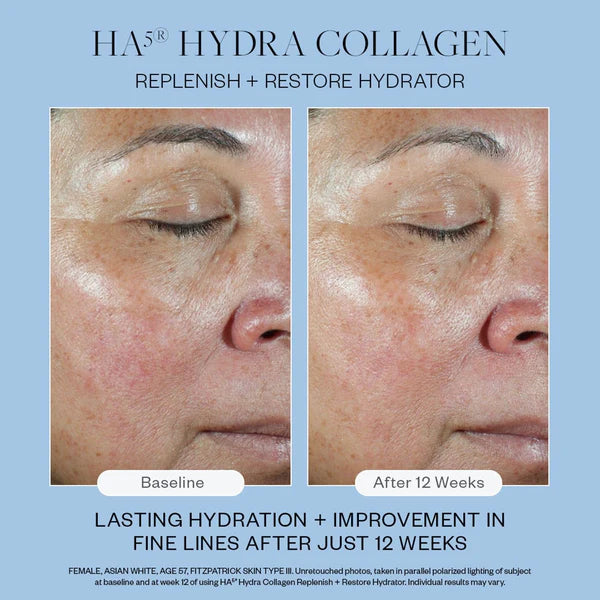 HA5 Hydra Collagen